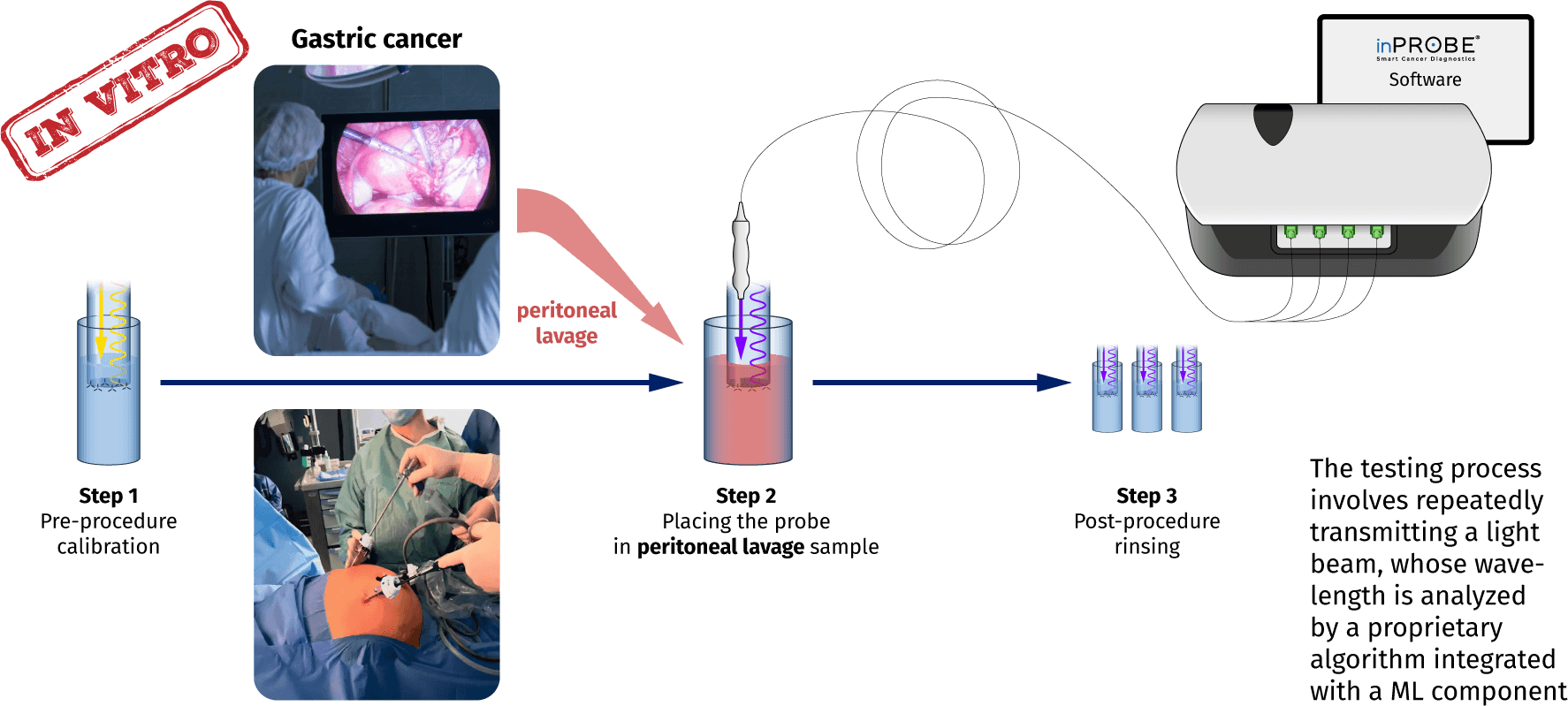 inPROBE technology overview