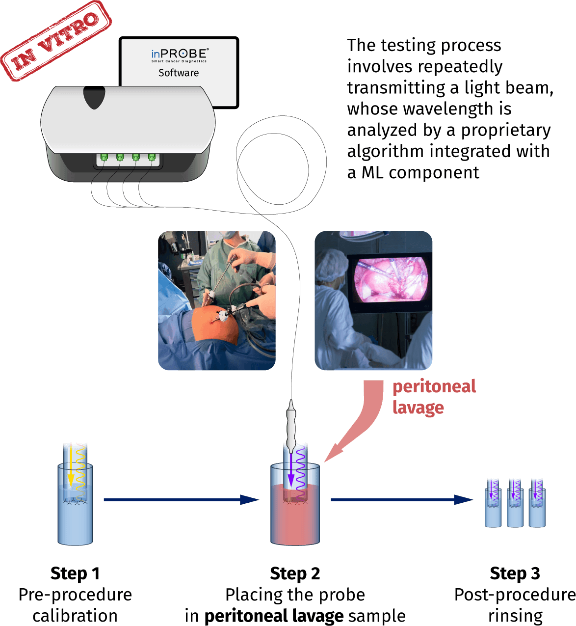 inPROBE technology overview