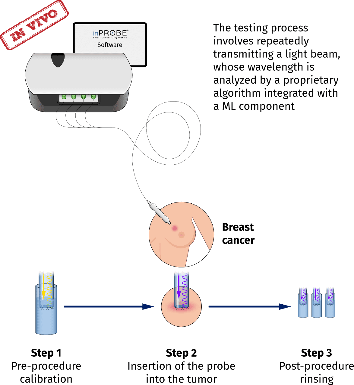 inPROBE technology overview