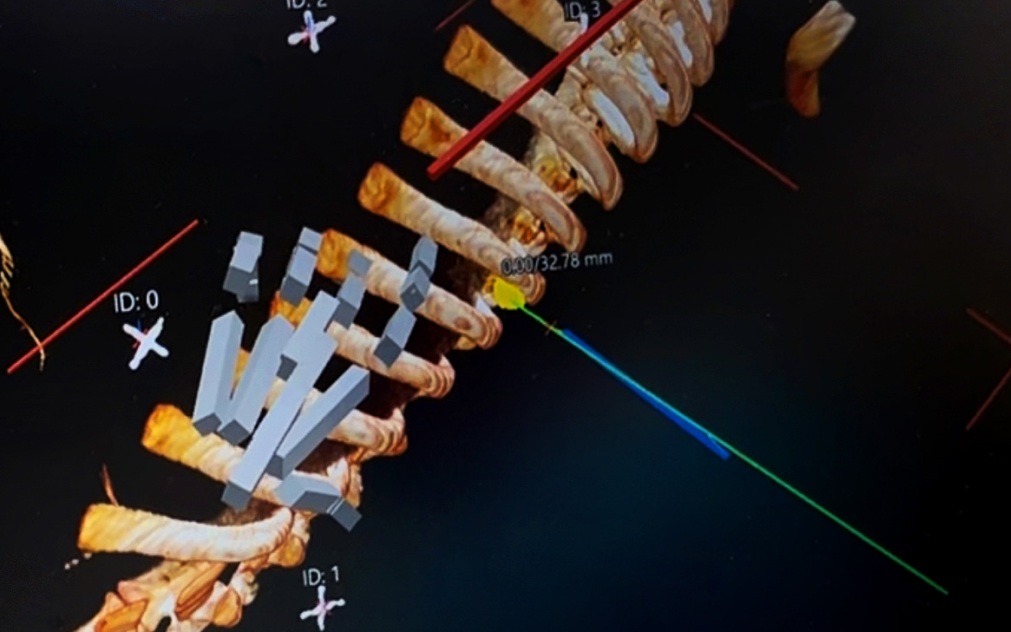 Computer screen view: imaging and biopsy needle trajectory