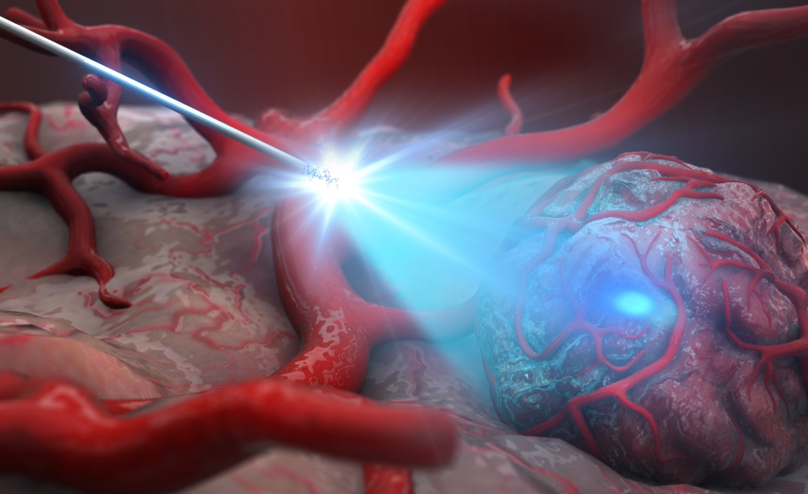 inPROBE Technology